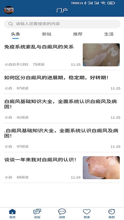 白癜風